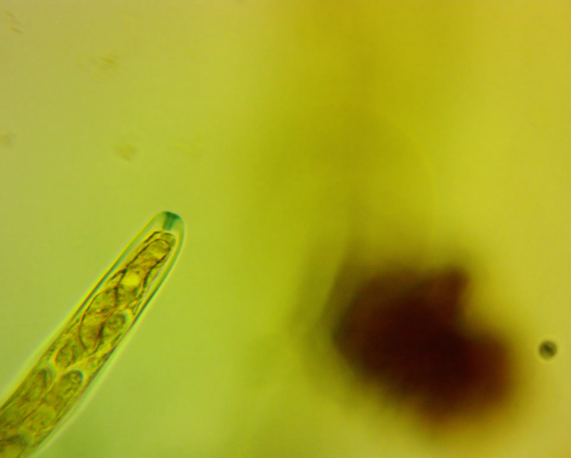 Microscopía de Lanzia echinophila - Ascos, 1000X Melzer (1)